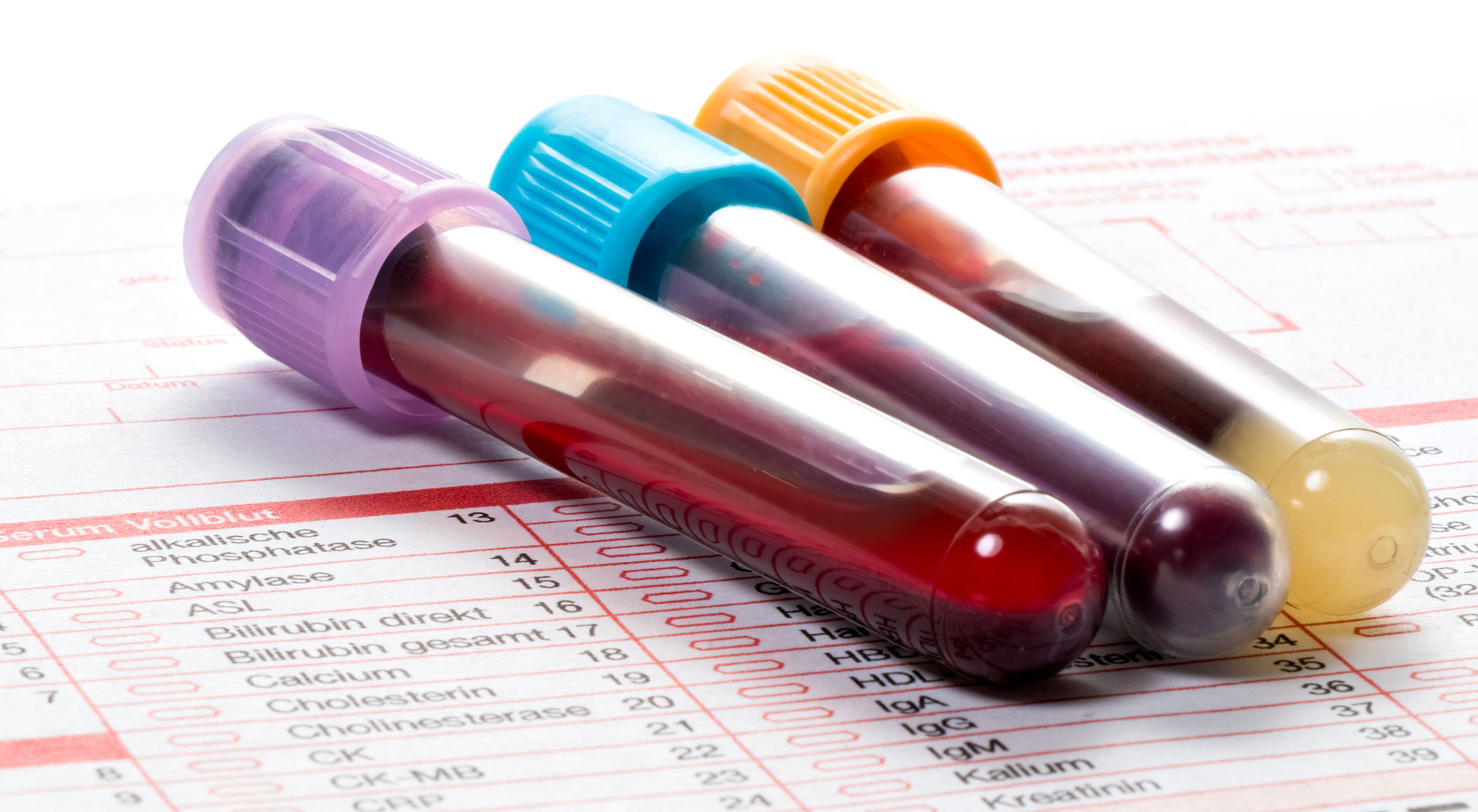 Labordiagnostik | (Blut / Stuhl) | Wiesloch – Frauenweiler