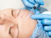 Mesotherapie | Wiesloch – Frauenweiler