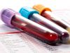 Labordiagnostik | (Blut / Stuhl) | Wiesloch – Frauenweiler