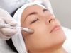 Mikrodermabrasion | Wiesloch – Frauenweiler